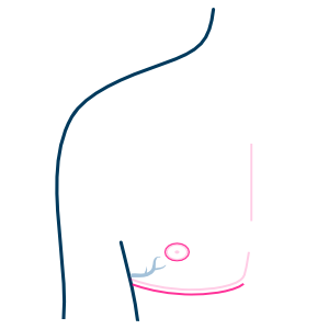 Sensory Preservation